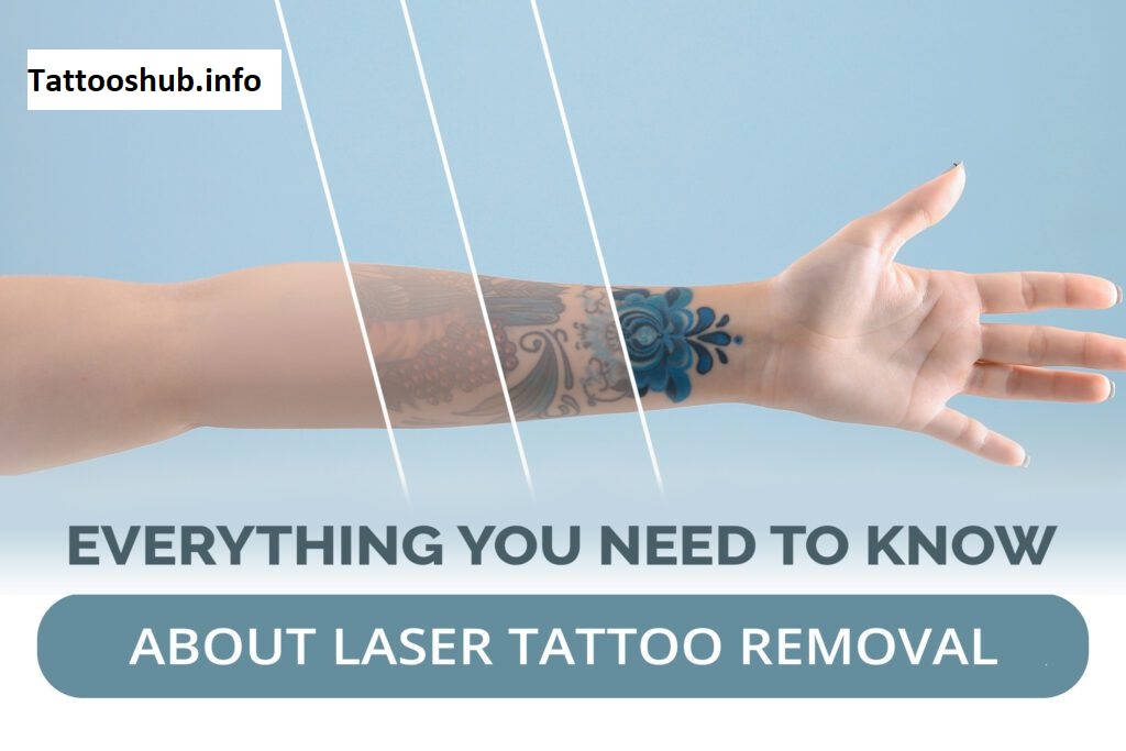 Does Tattoo Removal Hurt? 10 Laser Tattoo Removal FAQs 2025 Does Tattoo Removal Hurt? 10 Laser Tattoo Removal FAQs 2025